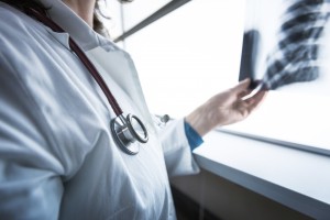 Female doctor checking xray image of lungs.